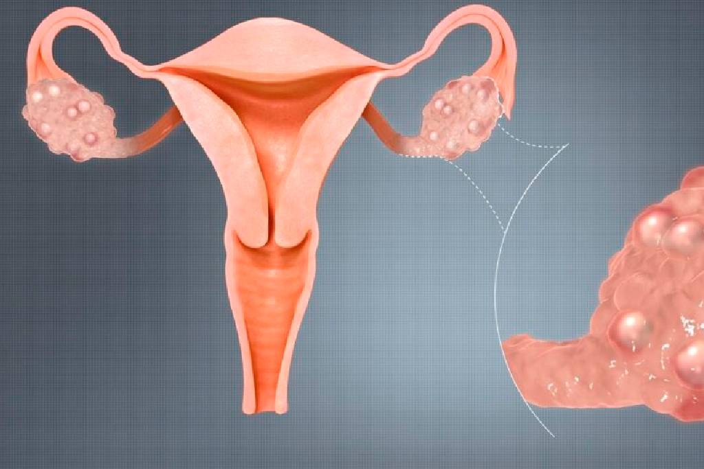 Women's health consultation